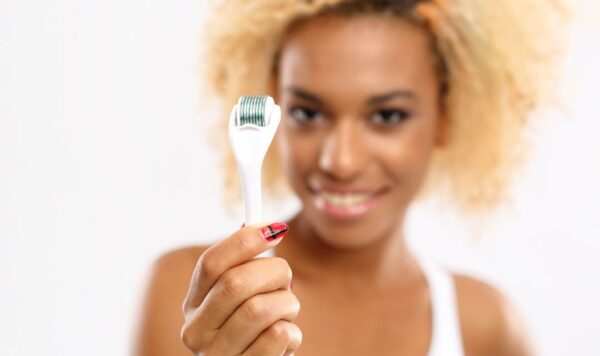 Derma Needling For  -Stretch Marks (small )