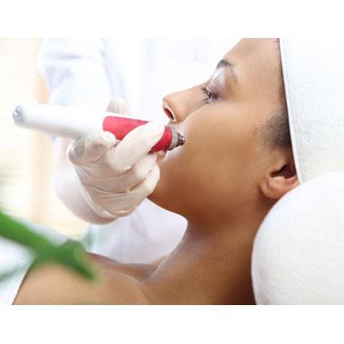 Derma Needling For Skin brightening and pigment elimination