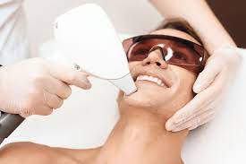 Half Beard Men Laser Removal